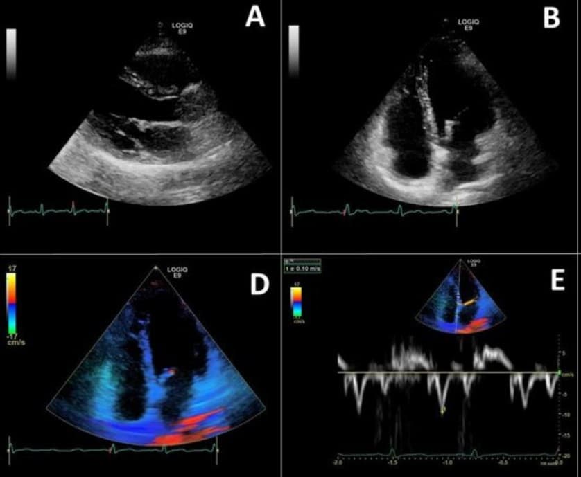 Cardiology Slide 2